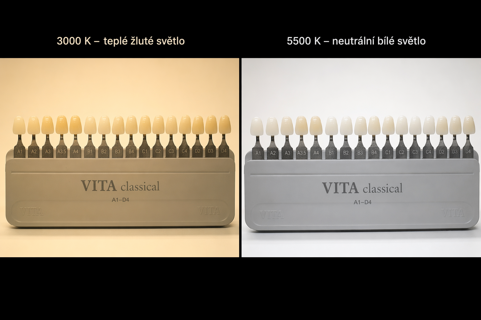 vliv teploty světla na vizuální vnímání barvy zubního vzorníku