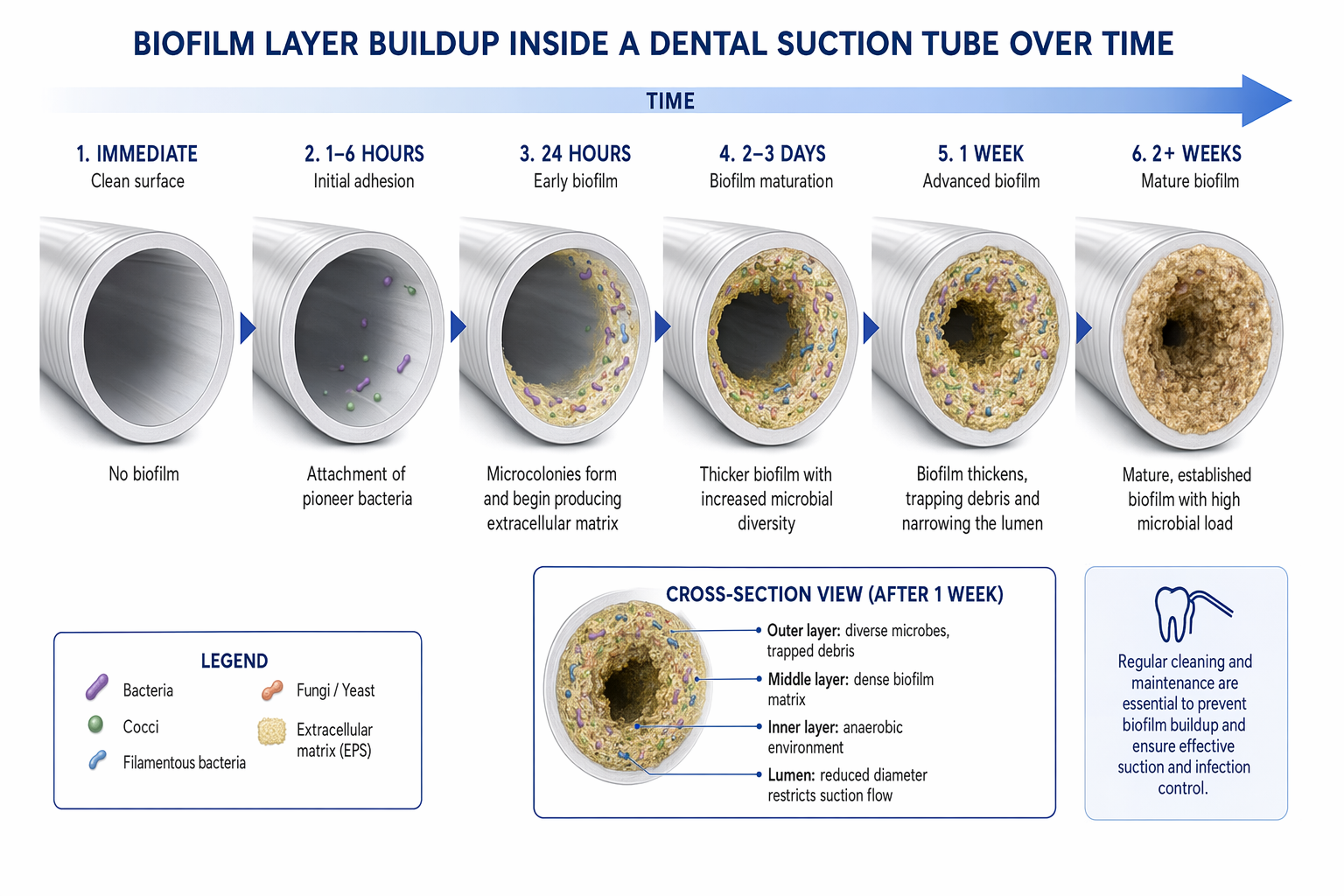 cross-section diagram of dental suction tubing with progressive biofilm accumulation